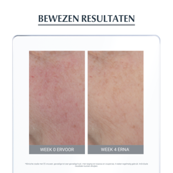 Eucerin Anti Redness Kalmerende Crème 50ml